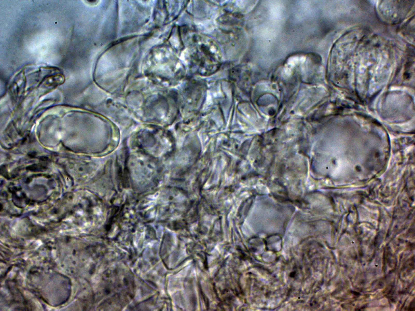 Microscopía de Leucocoprinus cepistipes - 13 - Suprapellis agua 1